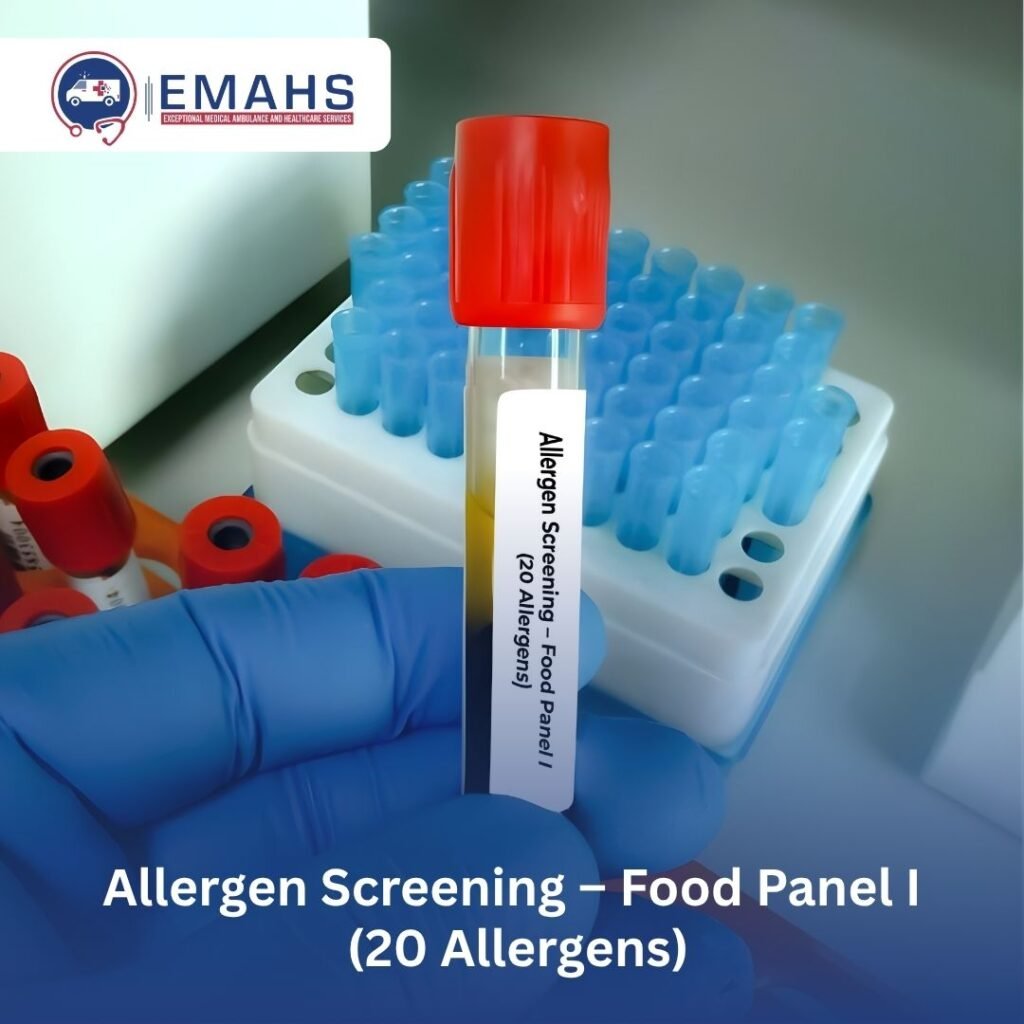 Allergen Screening – Food Panel I (20 Allergens)