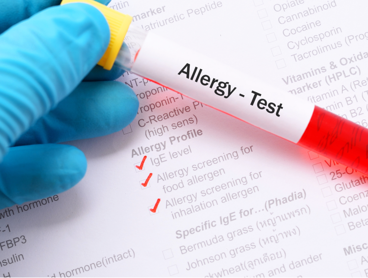 Allergen Screening