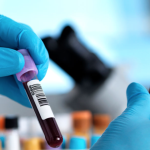 Immunoglobulin Panel