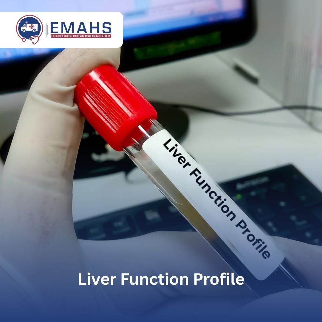 liver profile test
