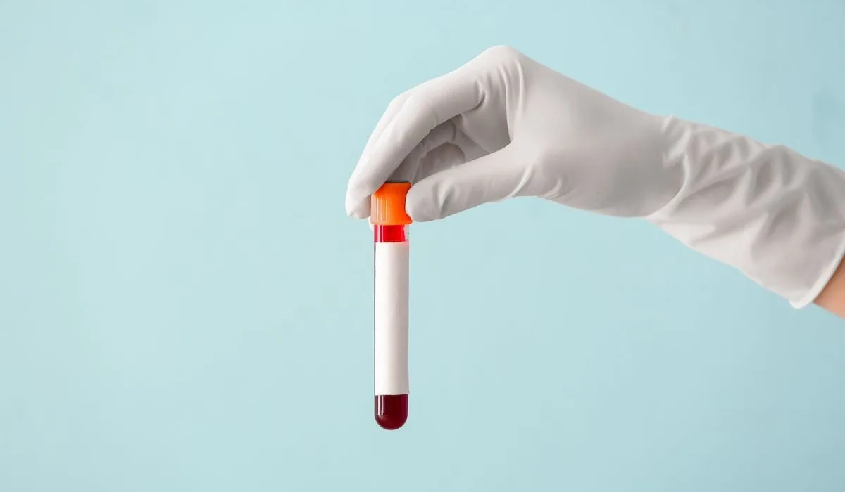 Blood Test at Home